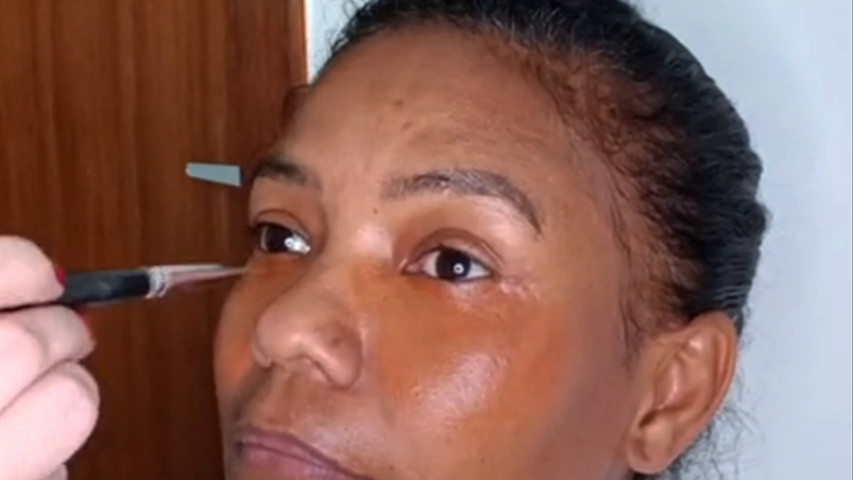 Camuflagem de Melasma