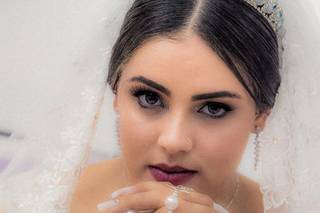 Laudo Leal Fotos - 8