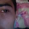 Erick
