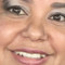 Telma