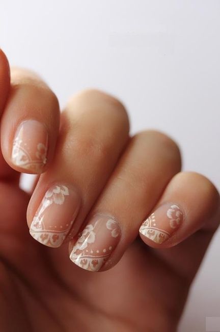 unhas