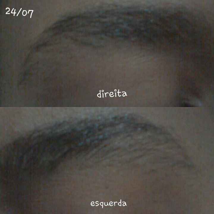 Projeto rapunzel - 2