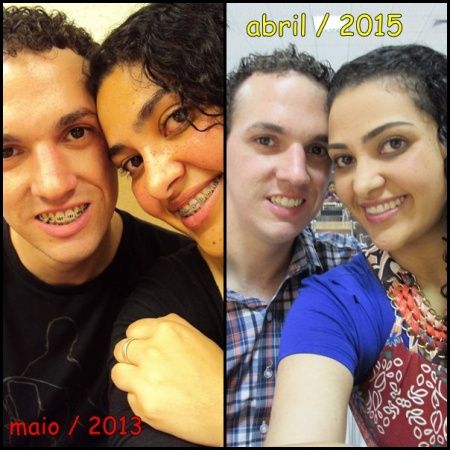 antes e depois
