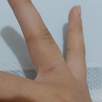 Alergia a Aliança - 1
