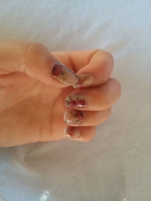 Unhas 