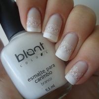 Unhas