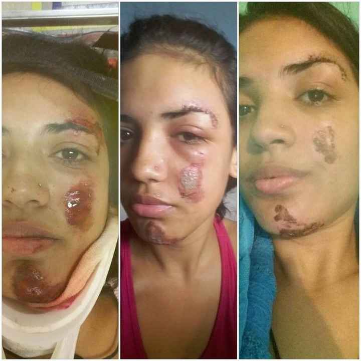 Meu rosto depois do acidente