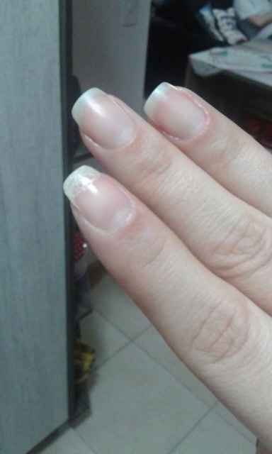 Uma pequena cirurgia!