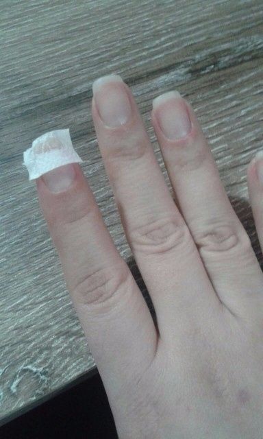 Uma pequena cirurgia!