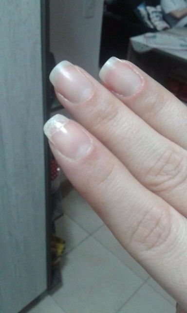 Uma pequena cirurgia!