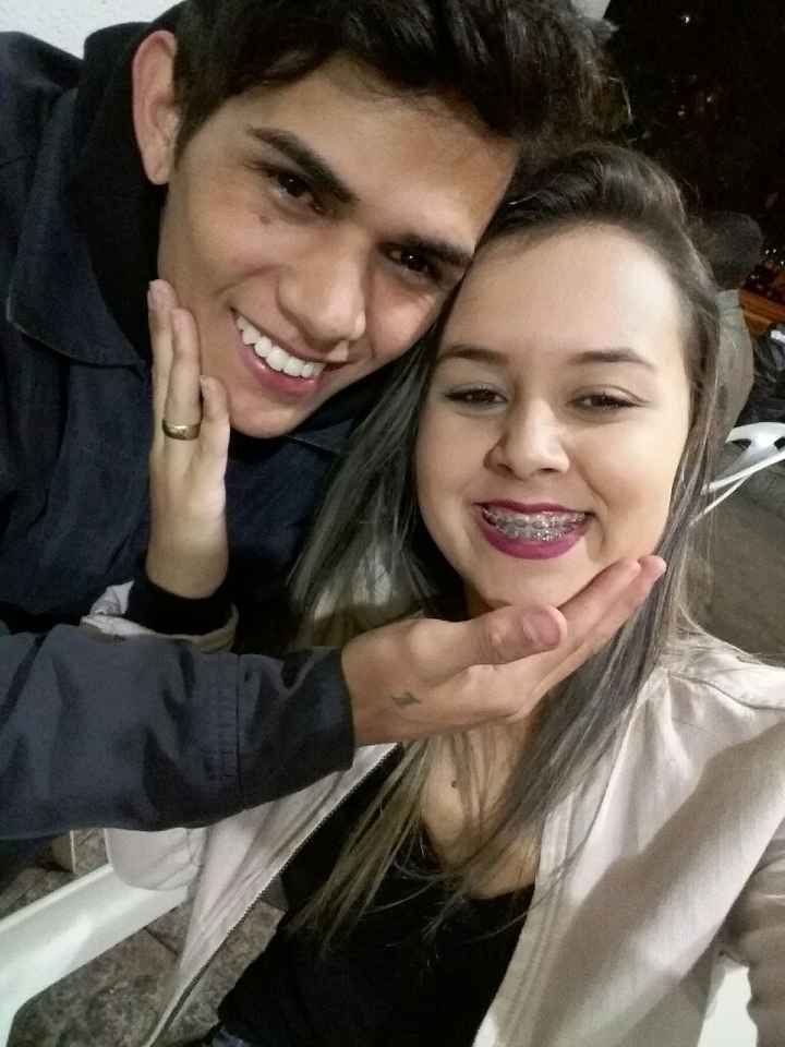 Tirei o aparelho - 1