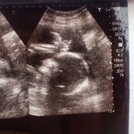 Ownty mamãe chega de fotos!!! srsrsr
