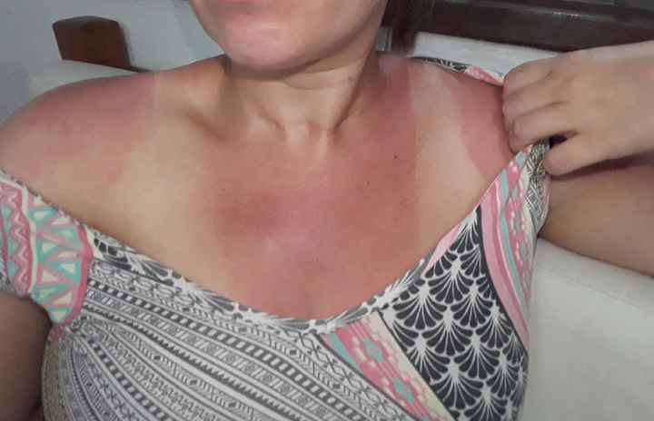 Marca de sol #socorro - 1