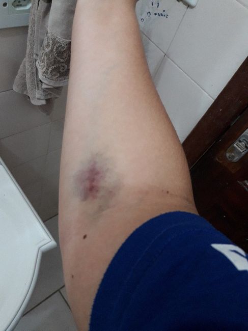 Olheiras roxas e maquiagem 2