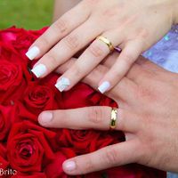  Unhas! o que fazer? - 1