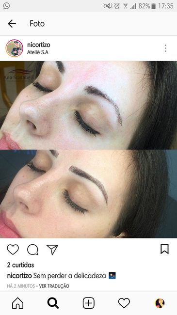 Antes e depois