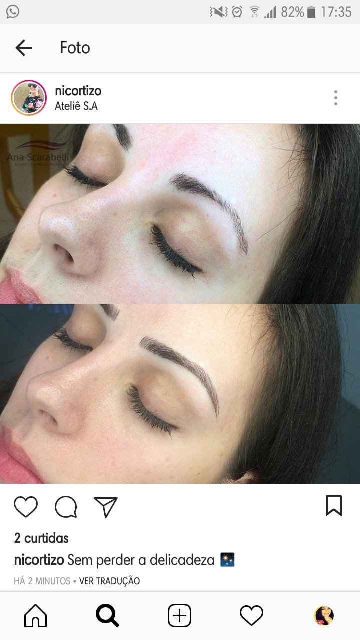 Antes e depois