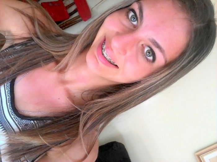 Tirei o aparelho \o/ - 3