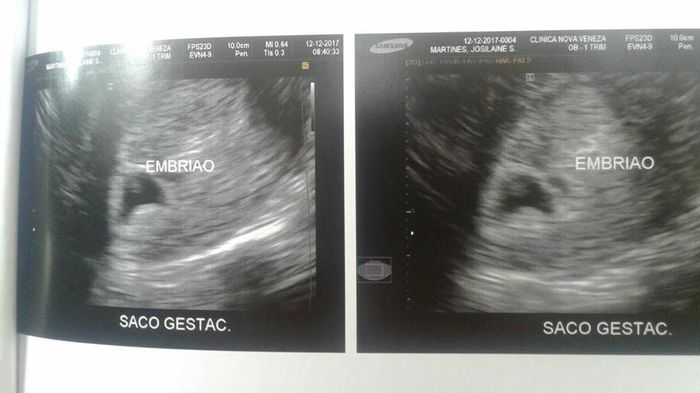 Primeira vez que vimos o bebê!! s2