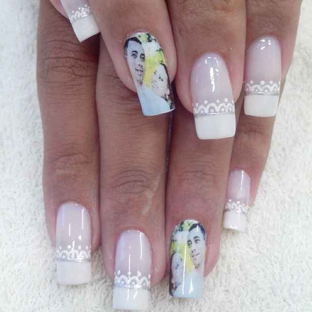 unhas