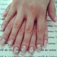 Unhas