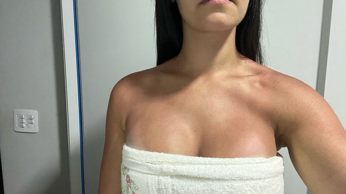 Vestido tomara que caia e marca de biquíni - 1