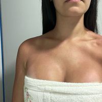 Vestido tomara que caia e marca de biquíni - 1