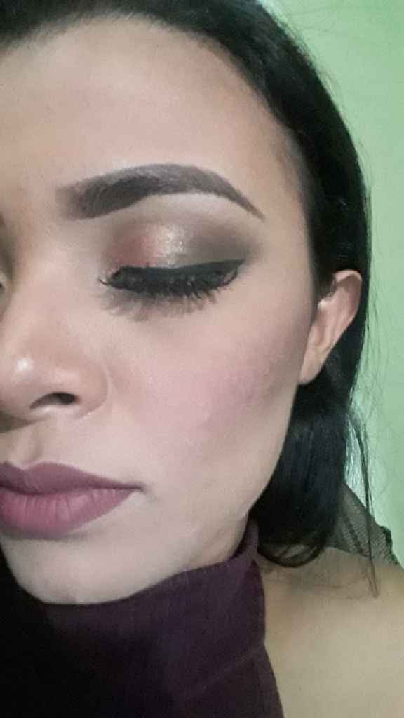 Minha experiência com acne, anticoncepcional e casamento (com Fotos) - 6