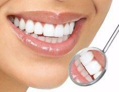 Clareamento dental