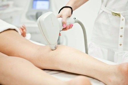 Depilação definitiva a laser