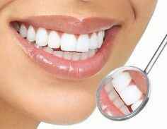 Clareamento dental