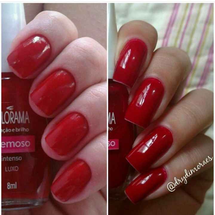 unhas