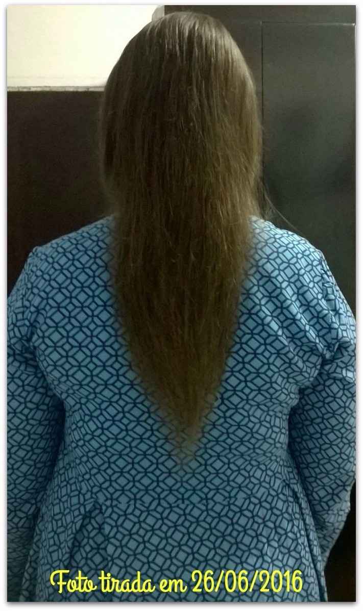 Antes