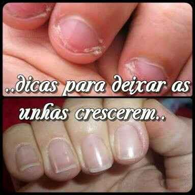 Noivinhas que roem unhas - 2