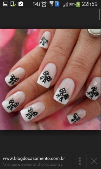 unhas