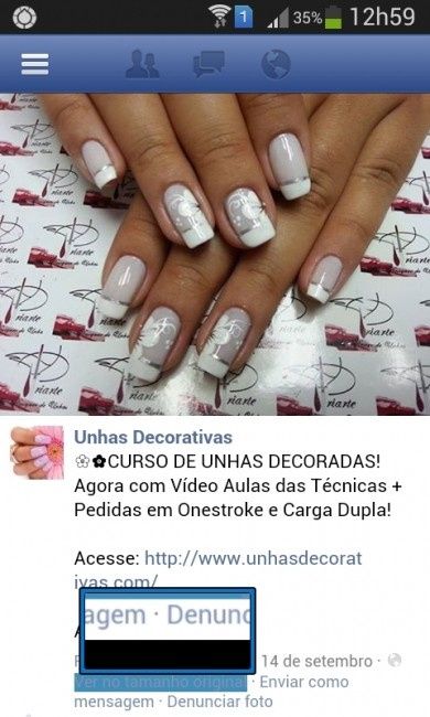 unhas