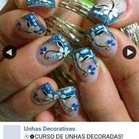 unhas