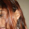 Cinira