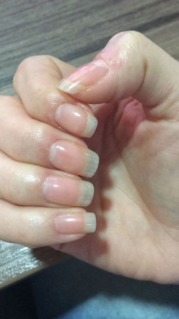  Unhas! o que fazer? - 1
