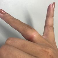 Mais alguém com esse probleminha?? 😣 - 1