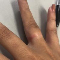 Mais alguém com esse probleminha?? 😣 - 3