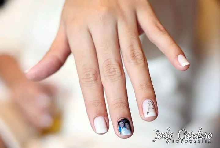 Unhas