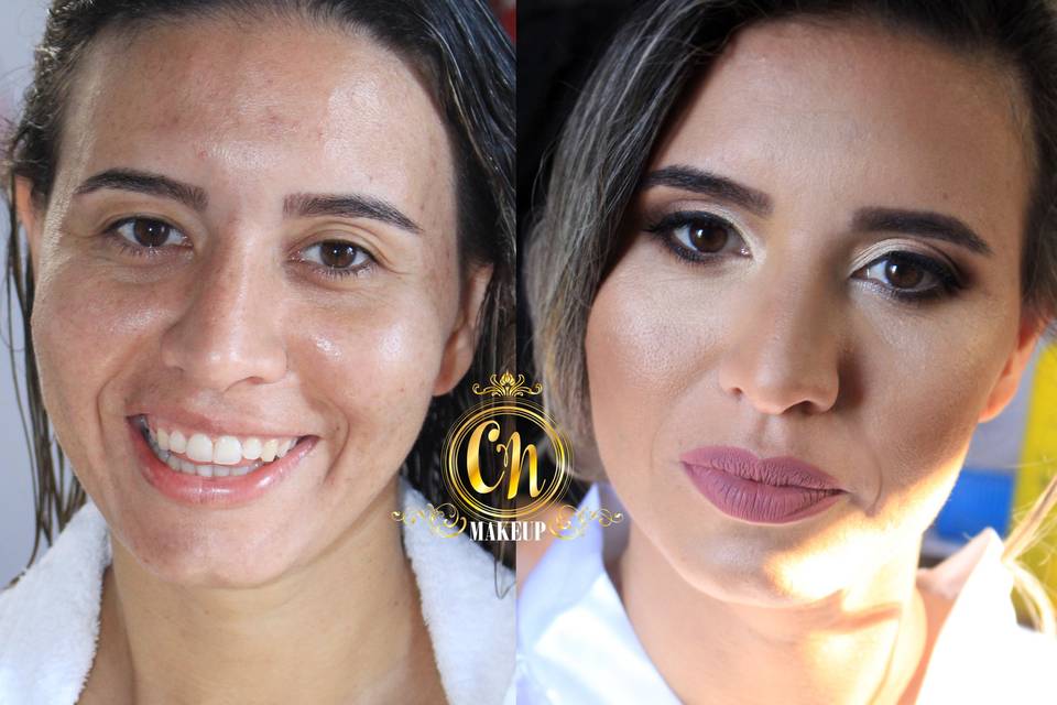 Noiva antes e depois