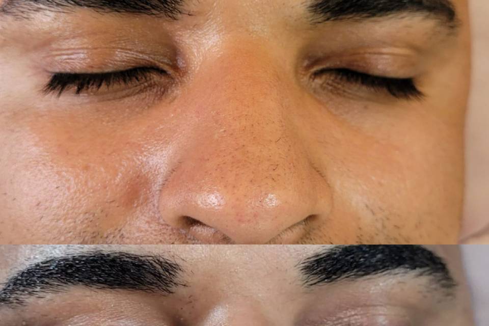 Limpeza de pele masculina