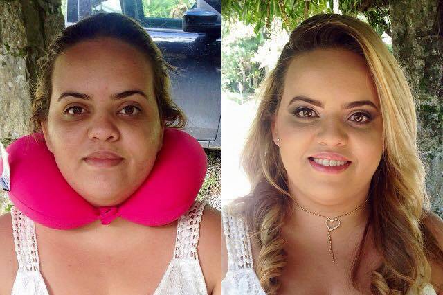 Antes X Depois