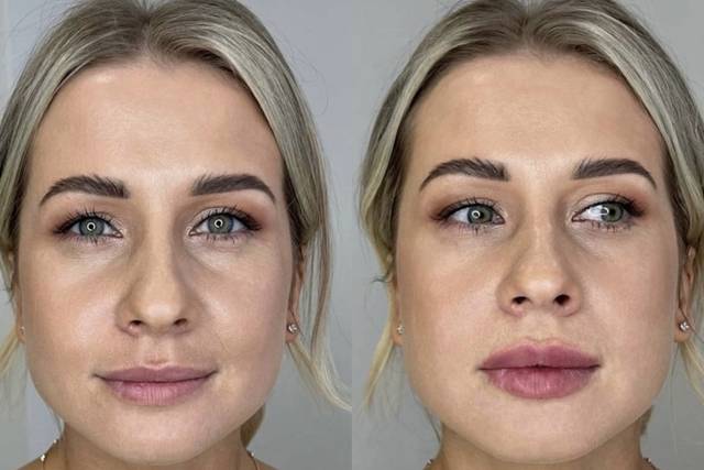 Full face