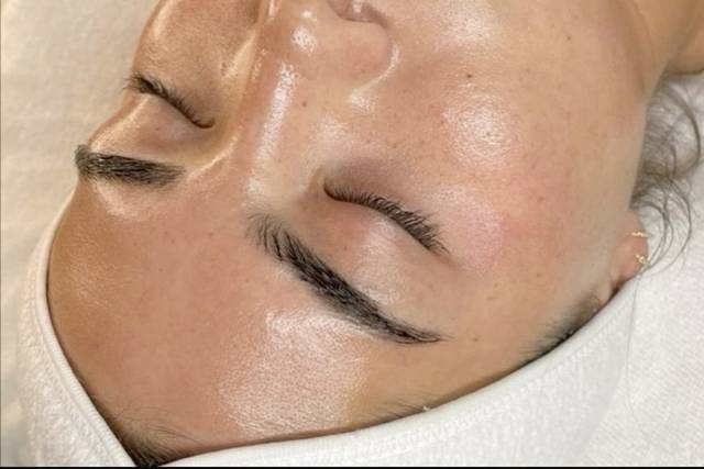 Gio Estética Avançada