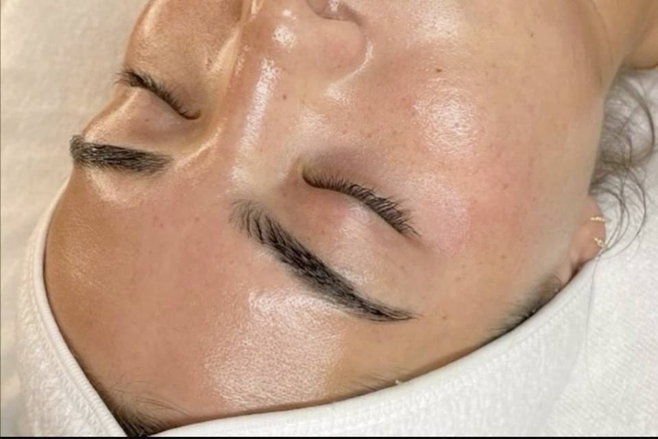 Gio Estética Avançada