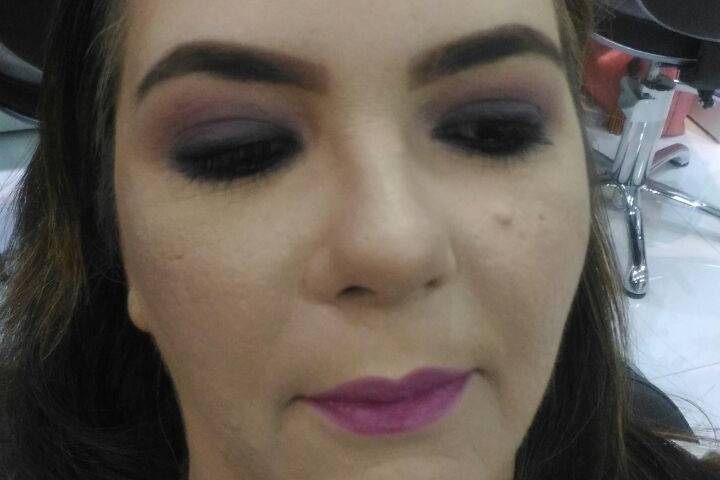 Correção de melasma na pele.