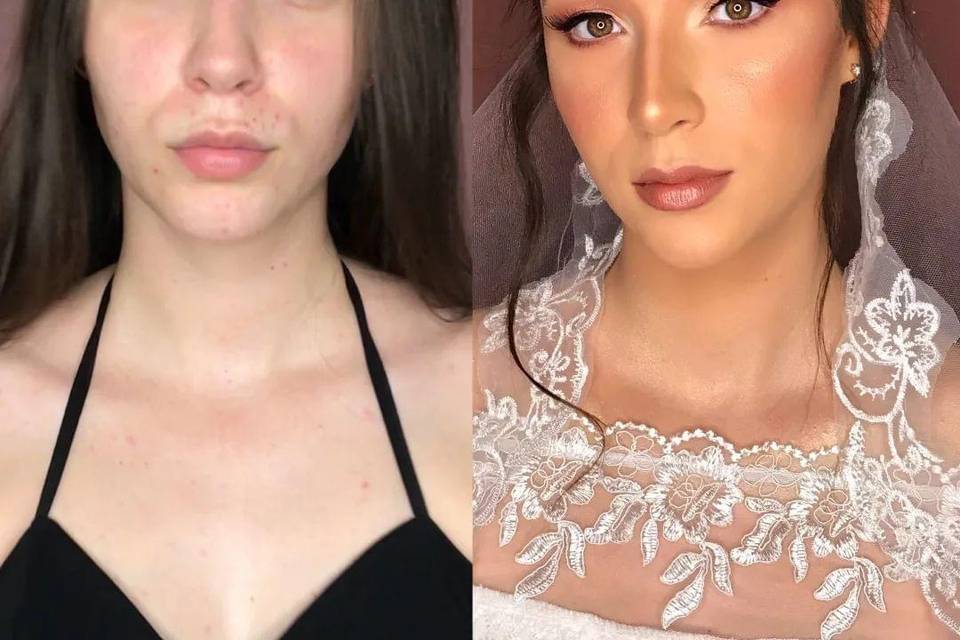 Antes e depois
